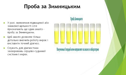 Аналіз сечі за Зимницьким