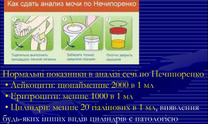 Аналіз сечі по Нечипоренко :: Міський лікувально-діагностичний центр м.Вінниця (МЛДЦ Вінниця)