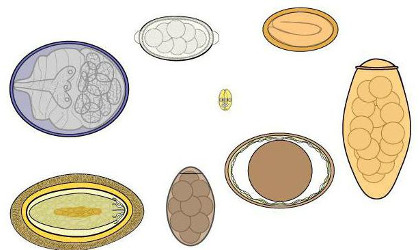 Яйця гельмінтів :: Міський лікувально-діагностичний центр м.Вінниця (МЛДЦ Вінниця)