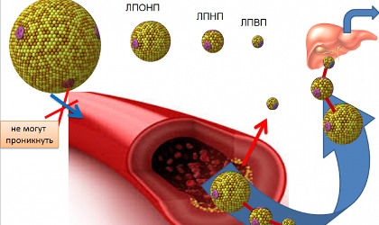 Ліпопротеїди низької щільності (ЛПНЩ) :: Міський лікувально-діагностичний центр м.Вінниця (МЛДЦ Вінниця)